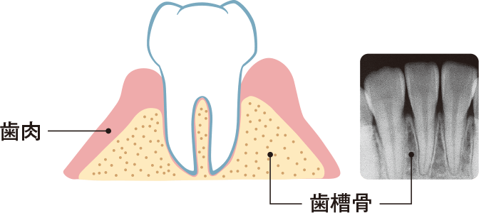 歯肉と歯槽骨の図
