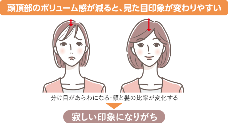 頭頂部のボリューム感が減ると、見た目印象が変わりやすい