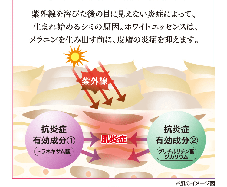 ステップ1 シミの引き金となる肌炎症を抑える