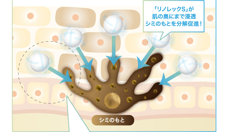 ステップ2 シミのもとを抑制　日本で唯一美白有効成分「リノレックS」