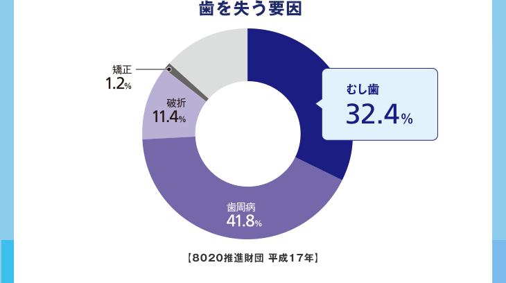 歯を失う要因 むし歯32.4% 歯周病41.8% 破折11.4% 矯正1.2%【8020推進財団 平成17年】