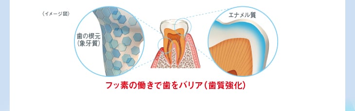 <イメージ図>フッ素の働きで歯をバリア(歯質強化)