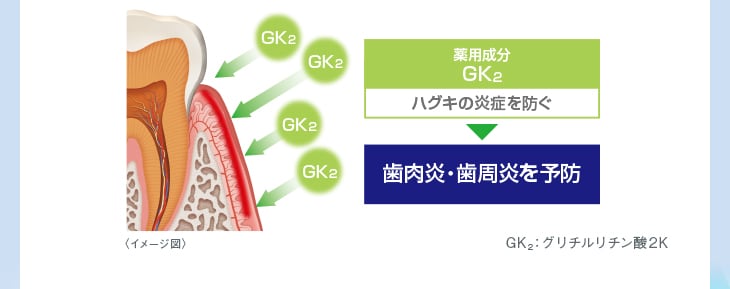 <イメージ図>薬用成分 GK2 ハグキの炎症を防ぐ 歯肉炎・歯周炎を予防 GK2:グリチルリチン酸2K