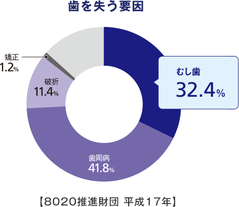 歯を失う要因 むし歯32.4% 歯周病41.8% 破折11.4% 矯正1.2%【8020推進財団 平成17年】