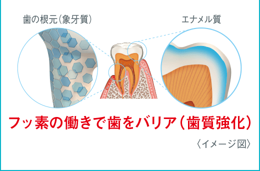 フッ素の働きで歯をバリア(歯質強化)<イメージ図>