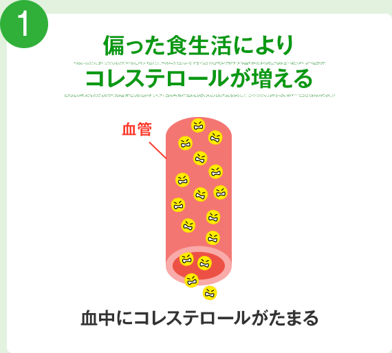 1.偏った食生活により、コレステロールが増える 血中にコレステロールがたまる