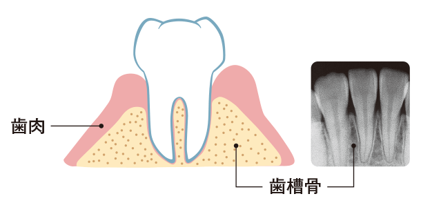 歯肉と歯槽骨の図