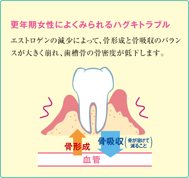 ハグキトラブルの図