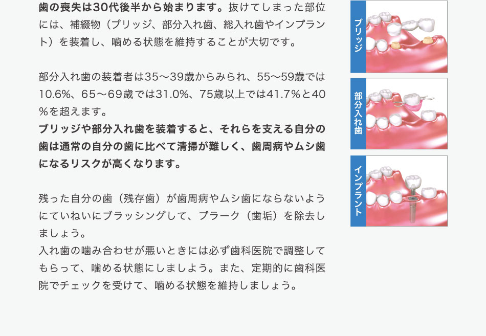 歯の喪失は30代後半から始まります。