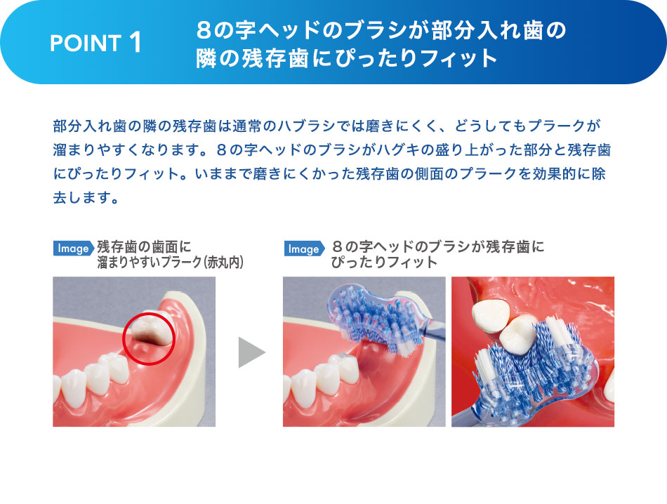 ８の字ヘッドのブラシが部分入れ歯の隣の残存歯にぴったりフィット