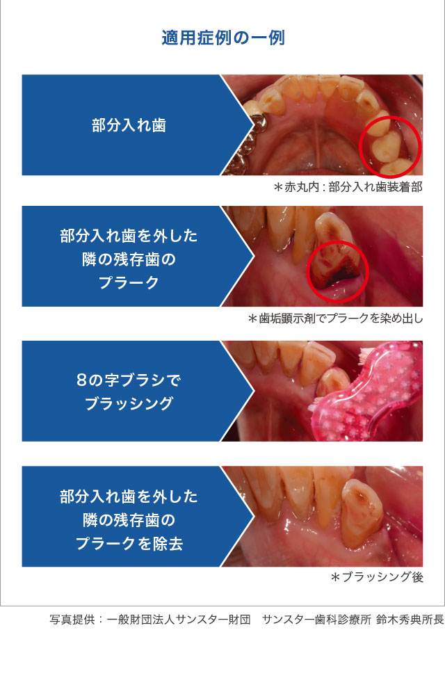 適用症例の一例