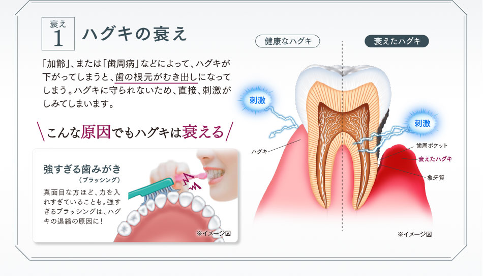 ハグキの衰え